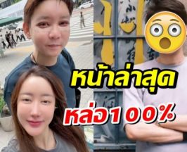ขยี้ตาเเทบหลุด! นี่คือหน้าล่าสุดของ จิน ธรรมวัฒนะ