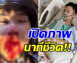 เปิดภาพนาทีชีวิต ตั้ม เดอะสตาร์ เลือดอาบ! หลังเกิดอุบัติเหตุใหญ่