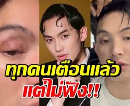 เตือนไม่ฟัง! มะตูม เจ็บหนัก หวั่นหายไม่ทันแคสงานที่เกาหลี