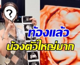 กรี๊ด! ดาราสาวดัง อวดภาพอัลตร้าซาวด์เบบี๋ ท้อง3เดือนแล้ว