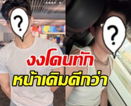 นักร้องหนุ่มดัง งง! โดนทักน่าเสียดาย หน้าเดิมดีกว่า