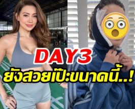 เปิดหมดไม่มีกั๊ก! โย ยศวดี เล่าประสบการณ์ดึงหน้า คุ้มค่าทุกบาท