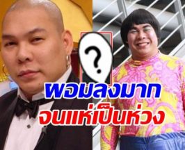 ชาวเน็ตตกใจ! ห่วง โหน่ง ชะชะช่า ทำไมผอมลงขนาดนี้