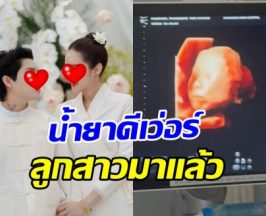 ยินดีด้วย! นางเอกดัง ท้องแล้ว หลังเพิ่งแต่งงานไม่กี่เดือน
