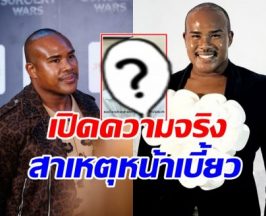 รัศมีแข เปิดภาพล่าสุด ใบหน้าเบี้ยว จนอดเป็นห่วงไม่ได้