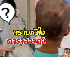 คนสวยใจบุญ ดาราสาวดัง ยื่นมือซัพพอร์ตเด็กศีรษะเป็นหนอง