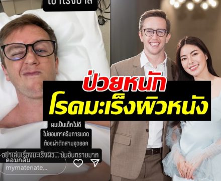 ส่งกำลังใจ! เนท My Mate Nate แจ้งข่าวป่วยมะเร็งผิวหนัง ต้องผ่าตัด