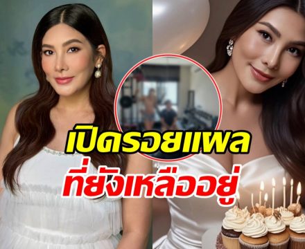 นุ่น รมิดา เปิดรอยแผลที่ท้อง เจอชาวเน็ตคอมเมนต์ซึ้งมาก