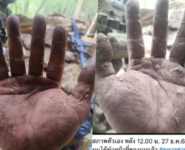 เห็นแล้วจุก! เผยสภาพมือทหารกล้า หลังเฝ้าชายแดนช่องอานม้า 20 วันรวด