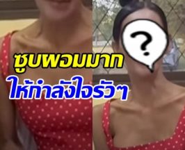 เห็นแล้วแห่เป็นห่วง เธอคนนี้ซูบผอม-ตาเหลือง ป่วย2โรคนี้