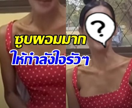 เห็นแล้วแห่เป็นห่วง เธอคนนี้ซูบผอม-ตาเหลือง ป่วย2โรคนี้