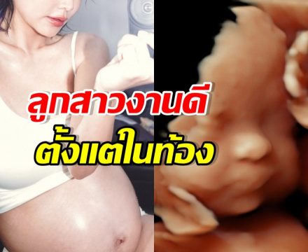 คุณแม่คนสวย เผยภาพลูกสาวในท้อง DNA พรีเมี่ยมสุดๆ