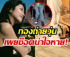 สุดห่วง! นางเอกดังสะดุดล้มหน้าคว่ำ ต้องใส่เฝือกอ่อน