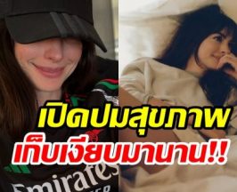 นางเอกตัวเเม่เล่าเบื้องหลังสุดเจ็บปวด เกือบสูญเสียดวงตาซ้าย