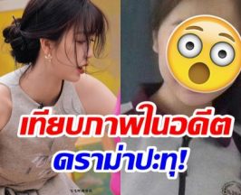 ซุปตาร์สาว งานเข้า! โดนอดีตเพื่อนสนิทเเฉประเด็นศัลยกรรม