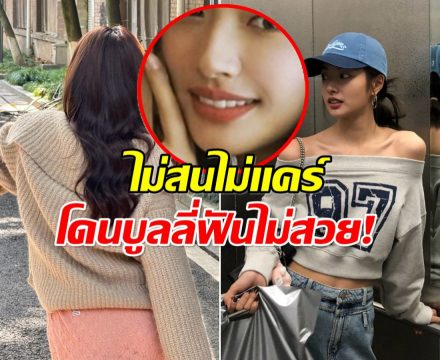 นางเอกดังไม่เเคร์ ฟาดกลับหลังเจอดราม่า โดนไล่ไปทำฟัน