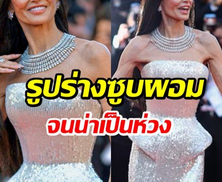 ชาวเน็ตตกใจภาพล่าสุด ซุปตาร์ตัวเเม่ ทำไมผอมลงขนาดนี้!