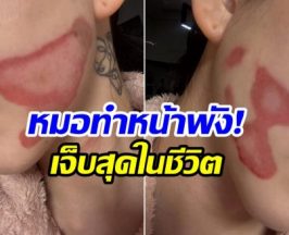 ใจสลาย! ศิลปินสาวเล่าทั้งน้ำตา อยากสวยเเต่หมอทำหน้าพัง!