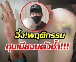 จับตาดราม่าร้อน พี่ชายซุปตาร์สาว ถูกเเฉทุบตีเมีย