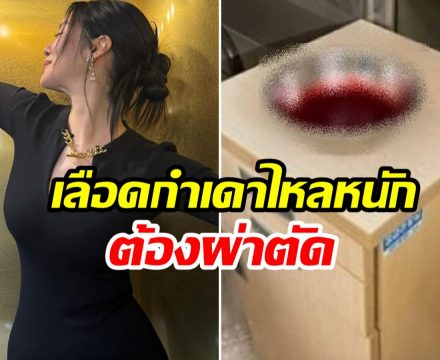 เเฟนๆใจหาย! นักเเสดงสาว เลือดกำเดาไหลรุนเเรงขั้นวิกฤต