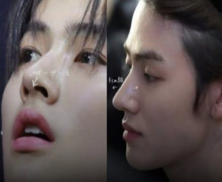 ความลับใต้ดั้งพุ่งหนุ่มคนดัง? ชาวเน็ตอ้างเจอแผลศัลยฯ