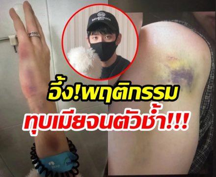 จับตาดราม่าร้อน พี่ชายซุปตาร์สาว ถูกเเฉทุบตีเมีย