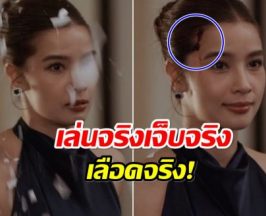 วิว วรรณรท ไม่ห่วงสวย ละครเรื่องใหม่ ยอมเจ็บจริง!