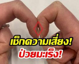 เช็กด่วน! ทำนิ้วเเบบนี้ รู้ผลมะเร็งภายใน 5 วินาที