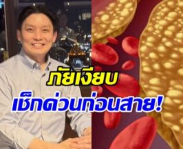 หมอวี แชร์อุทาหรณ์ เสี่ยงสโตรก-หัวใจวายไม่รู้ตัว พร้อมสูตรสู้กลับ