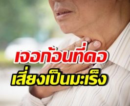 หมอเจด เตือน5ภาวะ คลำเจอก้อนที่คอ เสี่ยงเป็นมะเร็งไม่รู้ตัว