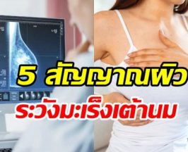 เช็ก! 5 สัญญาณผิวแบบไหนต้องระวังมะเร็งเต้านม