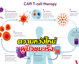 ศิริราชผลิต CAR T-Cell ต้นทุนต่ำ เปิดโอกาสการเข้าถึงการรักษามะเร็ง