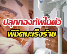 หมอญี่ปุ่นเผยเคล็ดลับ ปลุกกองทัพในตัว พิชิตมะเร็งร้าย